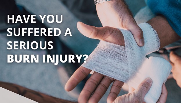 Have you suffered a serious burn injury?